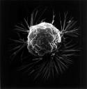 breast cancer cell